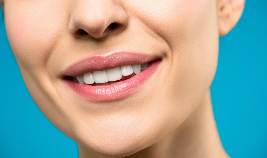 dental veneers in dubai