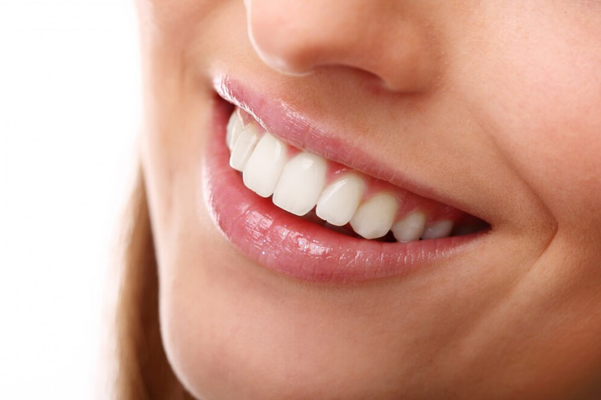 Snap-On Smile vs. Traditional Veneers: Which is Right for You?